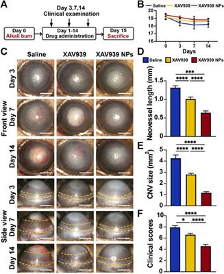 Ocular Wnt/β-Catenin Pathway Inhibitor XAV939-Loaded Liposomes for Treating Alkali-Burned Corneal Wound and Neovascularization